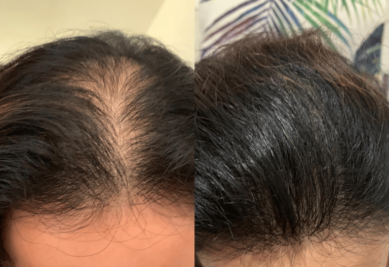 Hairspec Singapore